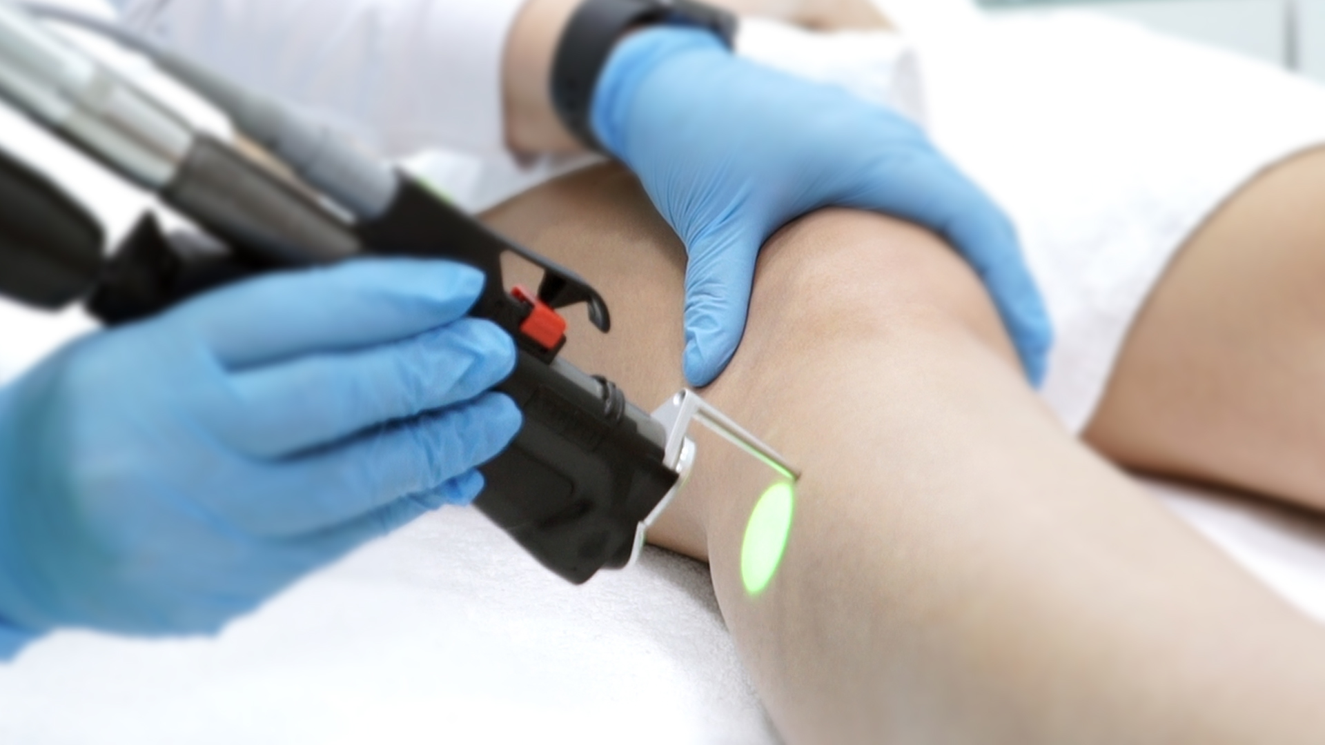 Desmistificando a relação entre a Depilação a Laser e o câncer