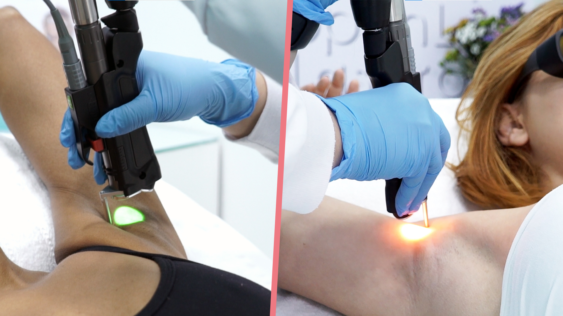 Depilação a Laser na BestLaser Funciona e Você Não Precisa contratar mais sessões por conta da cor da sua pele.