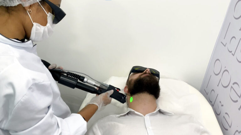 Porque a Depilação a Laser na Faixa de Barba e na Barba completa são as mais procuradas pelos homens?