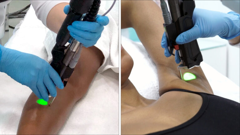 Tecnologia Avançada para Peles Negras e Pretas